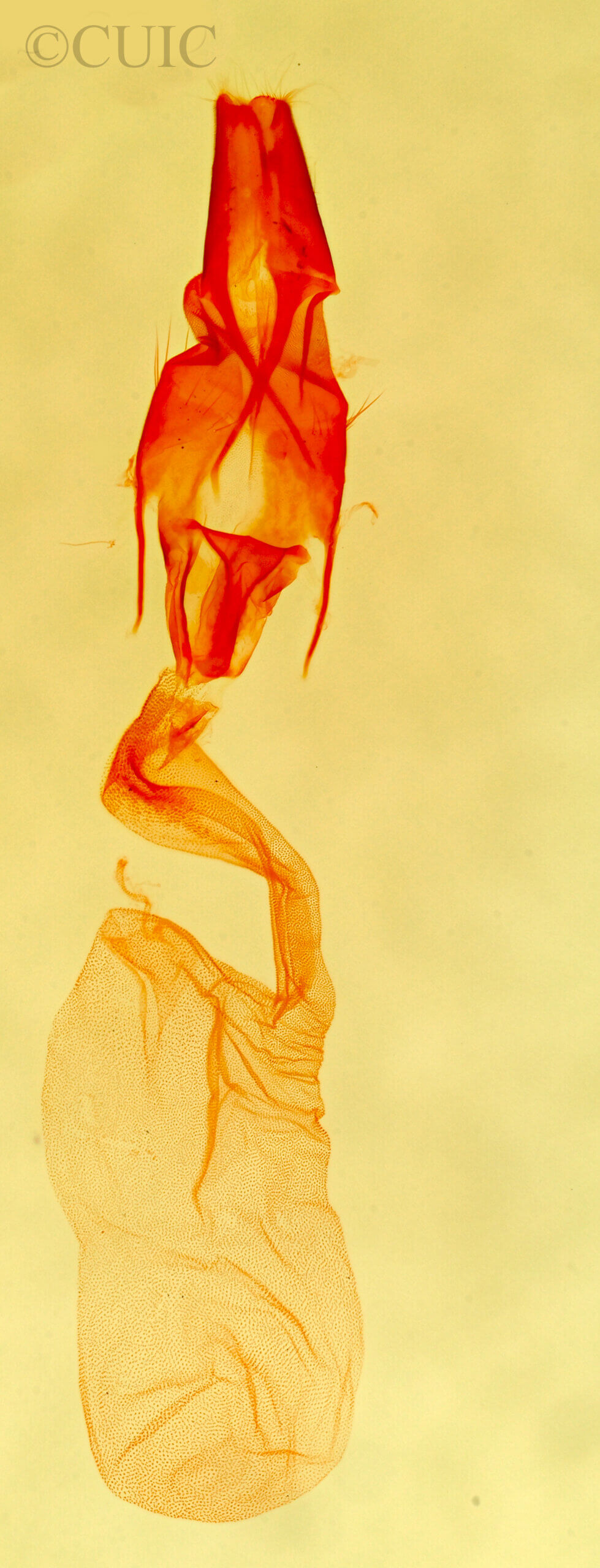 genitalia view of adult Protodeltote muscosula