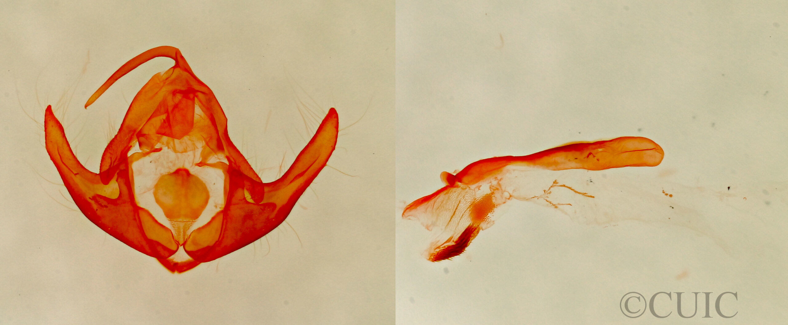 genitalia view of adult Protodeltote albidula