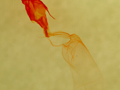 genitalia view of adult Protodeltote albidula