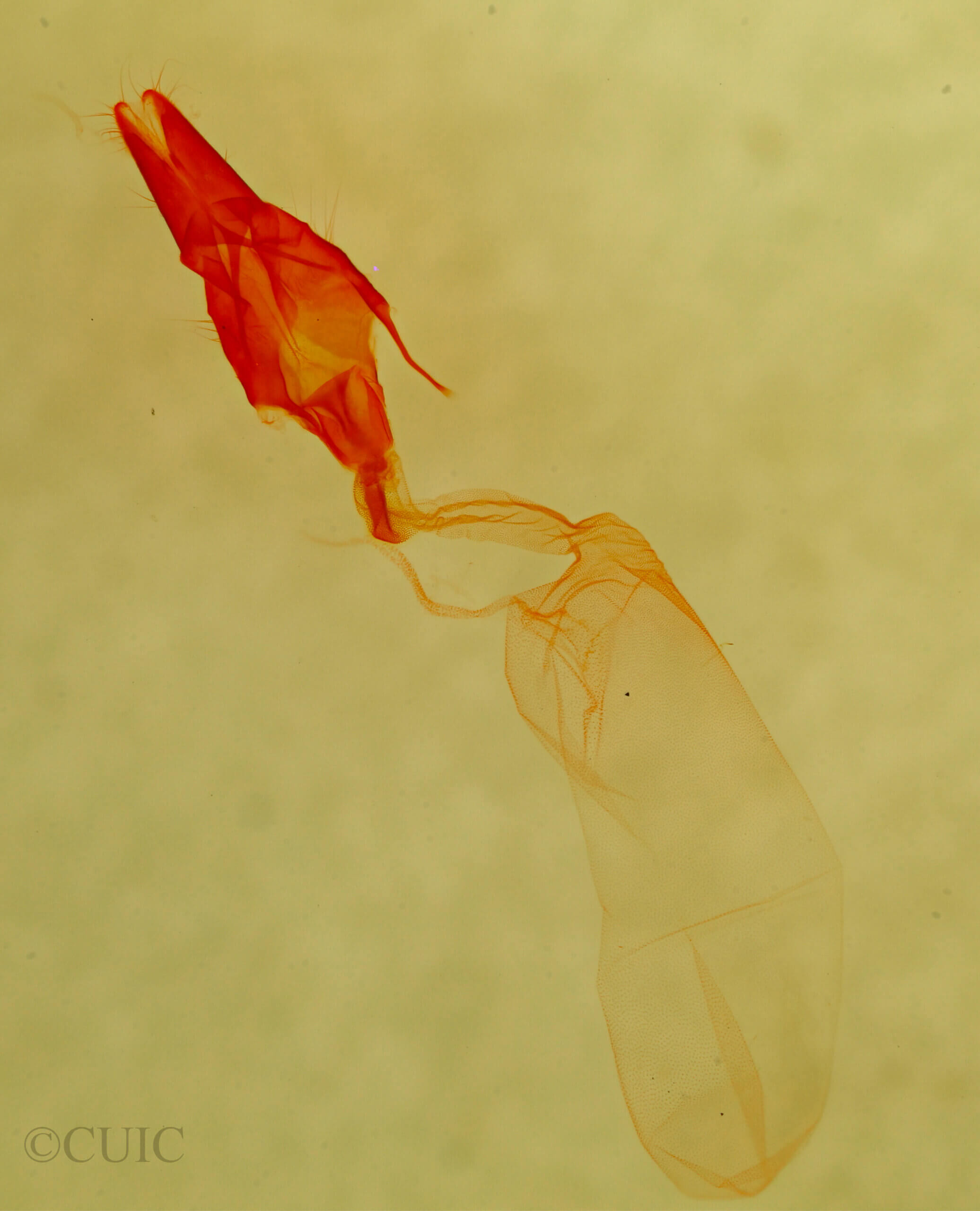 genitalia view of adult Protodeltote albidula