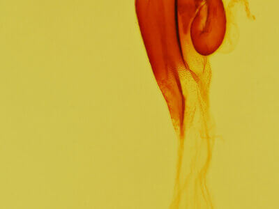 genitalia view of adult Hypenula  caminalis