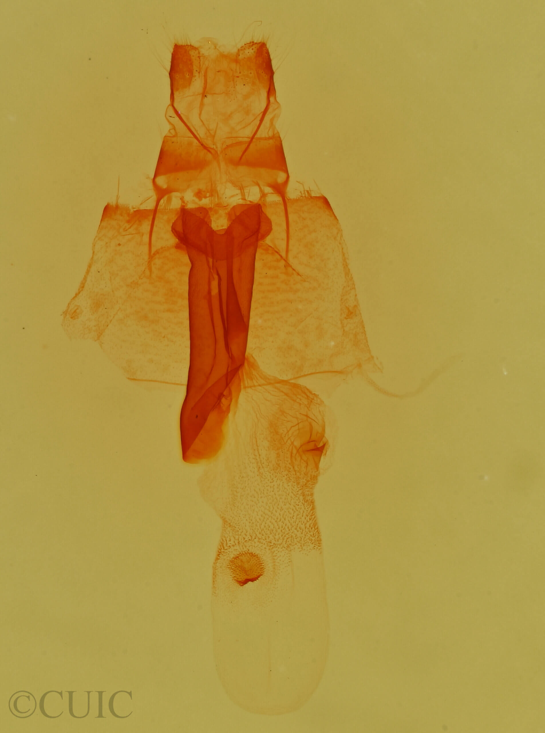 genitalia view of adult Lascoria  ambigualis 