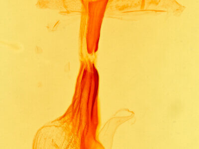 genitalia view of adult Palthis  angulalis 