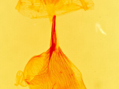 genitalia view of adult Lascoria 