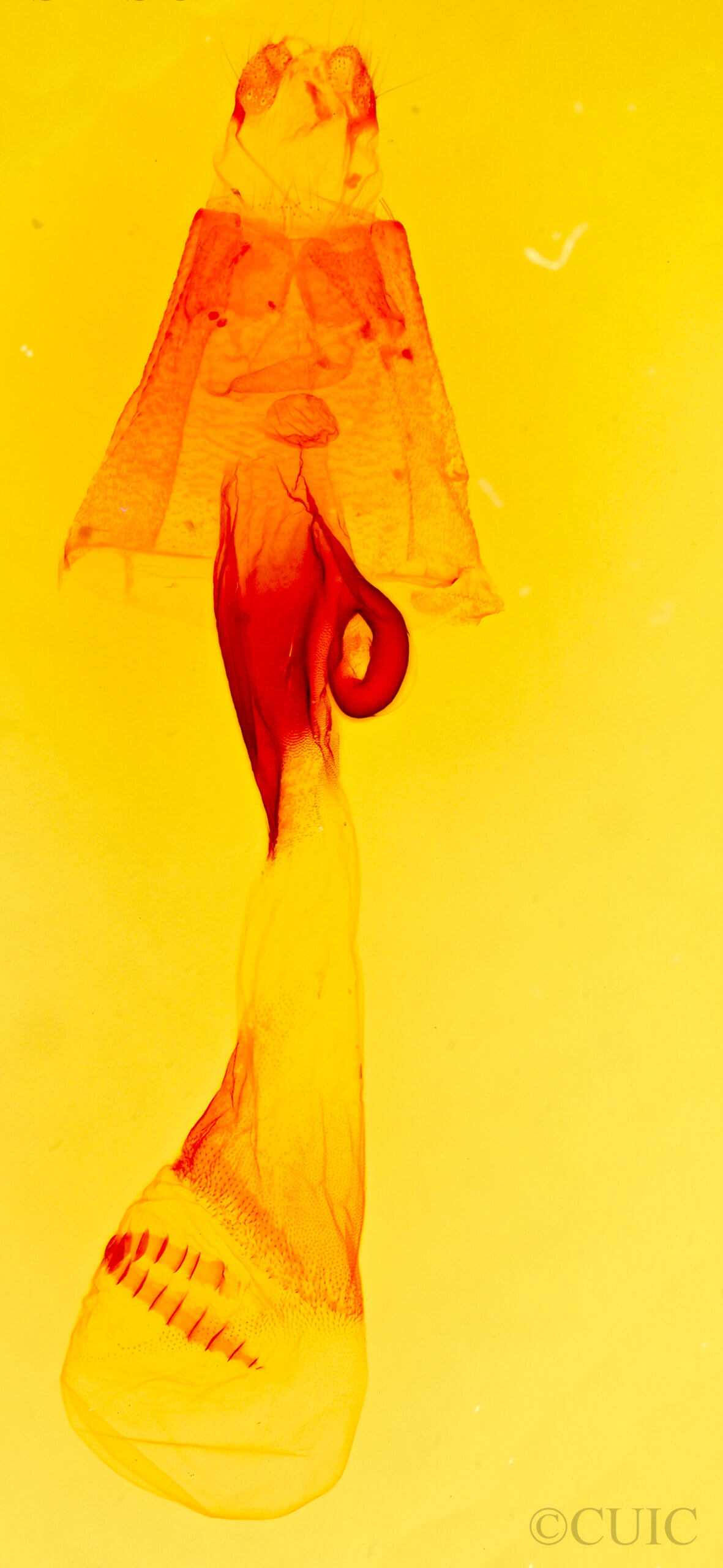 genitalia view of adult Hypenula  caminalis