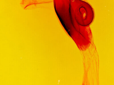 genitalia view of adult Hypenula  cacuminalis 