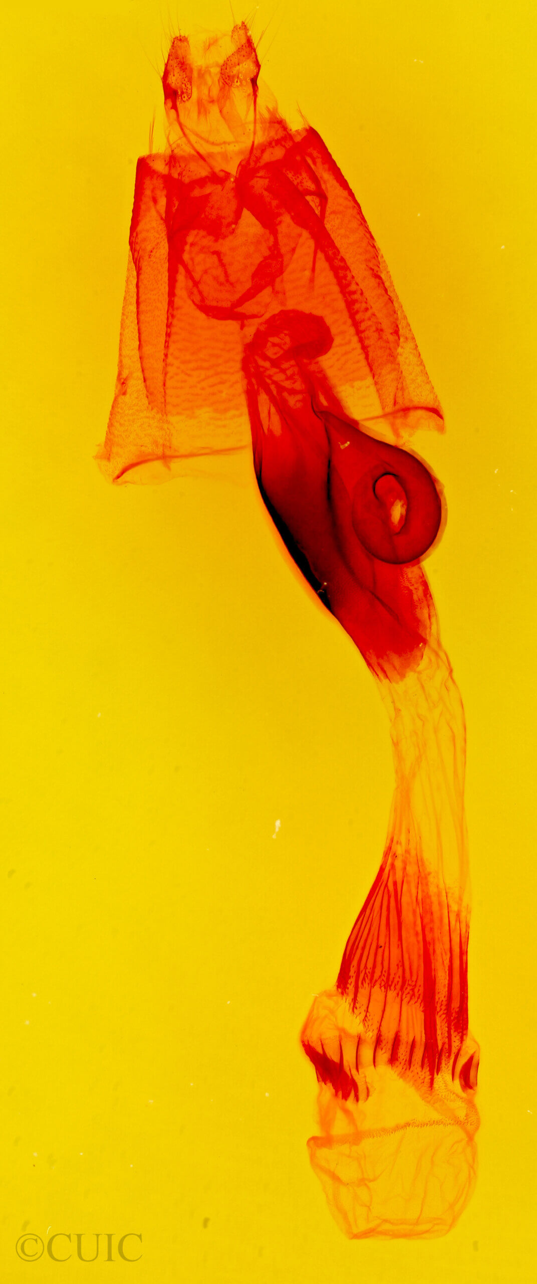 genitalia view of adult Hypenula  cacuminalis 