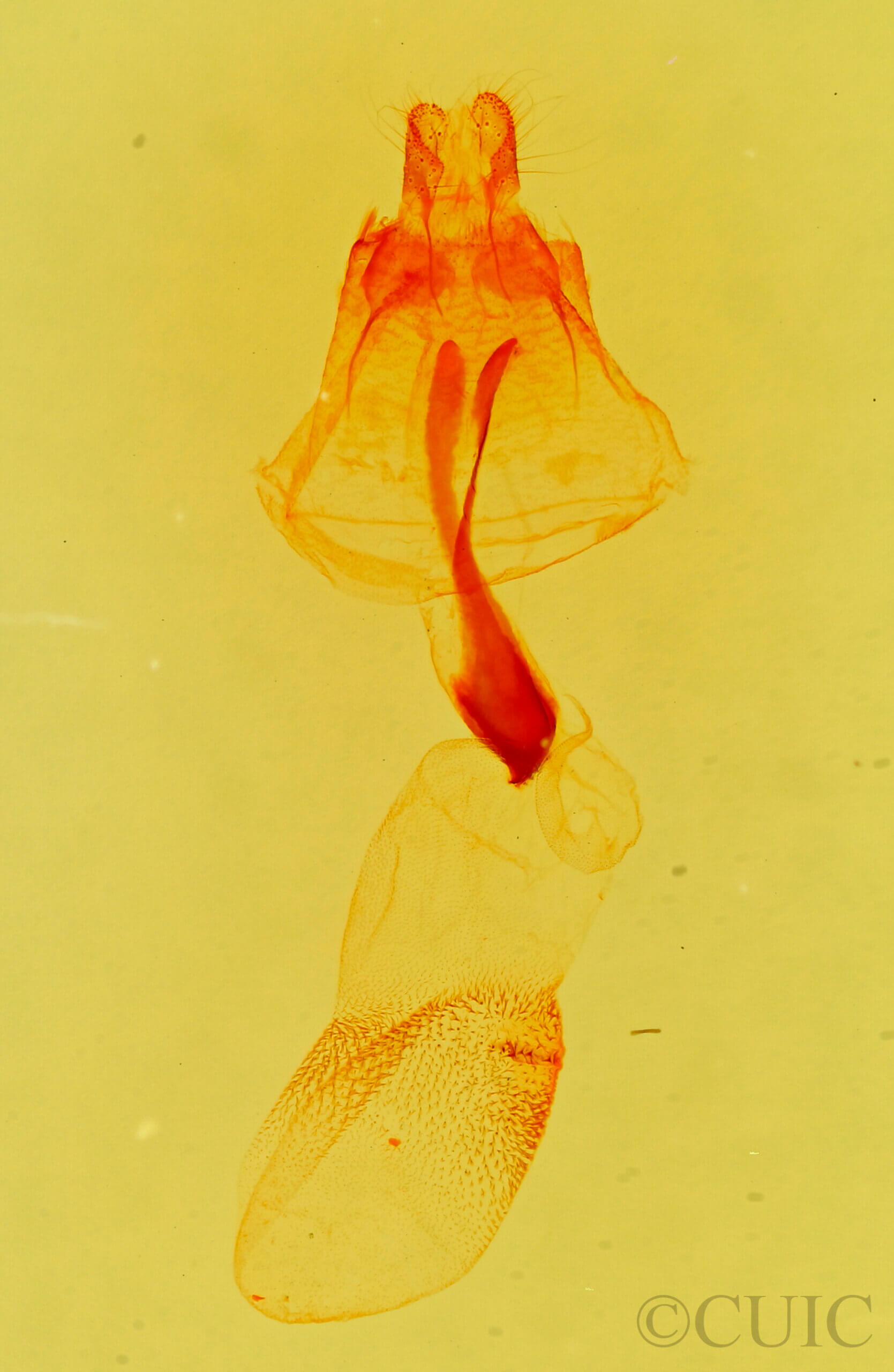 genitalia view of adult Tetanolita  mynesalis