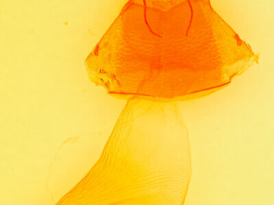 genitalia view of adult Amphipyra pyramidoides