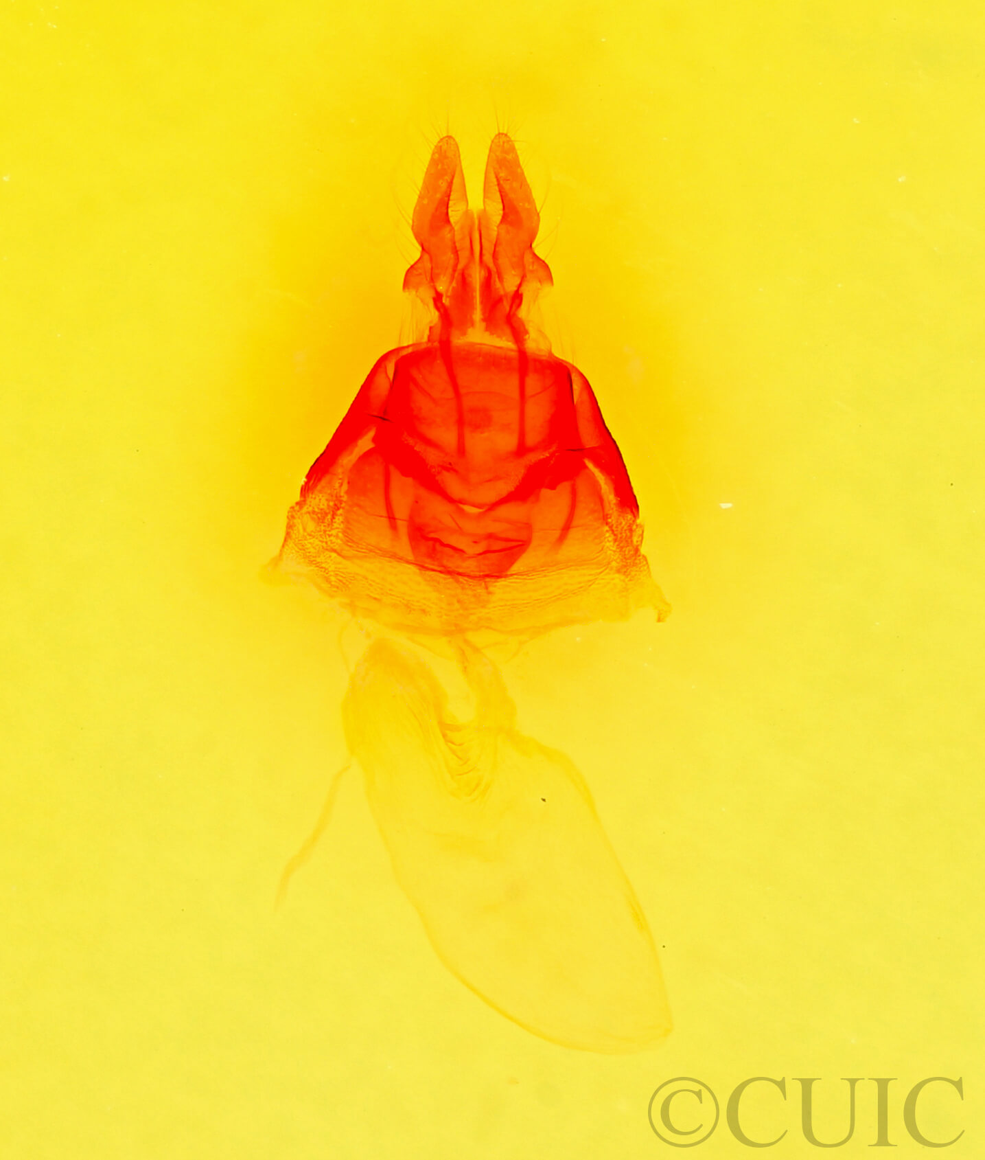 genitalia view of adult Mesapamea fractilinea