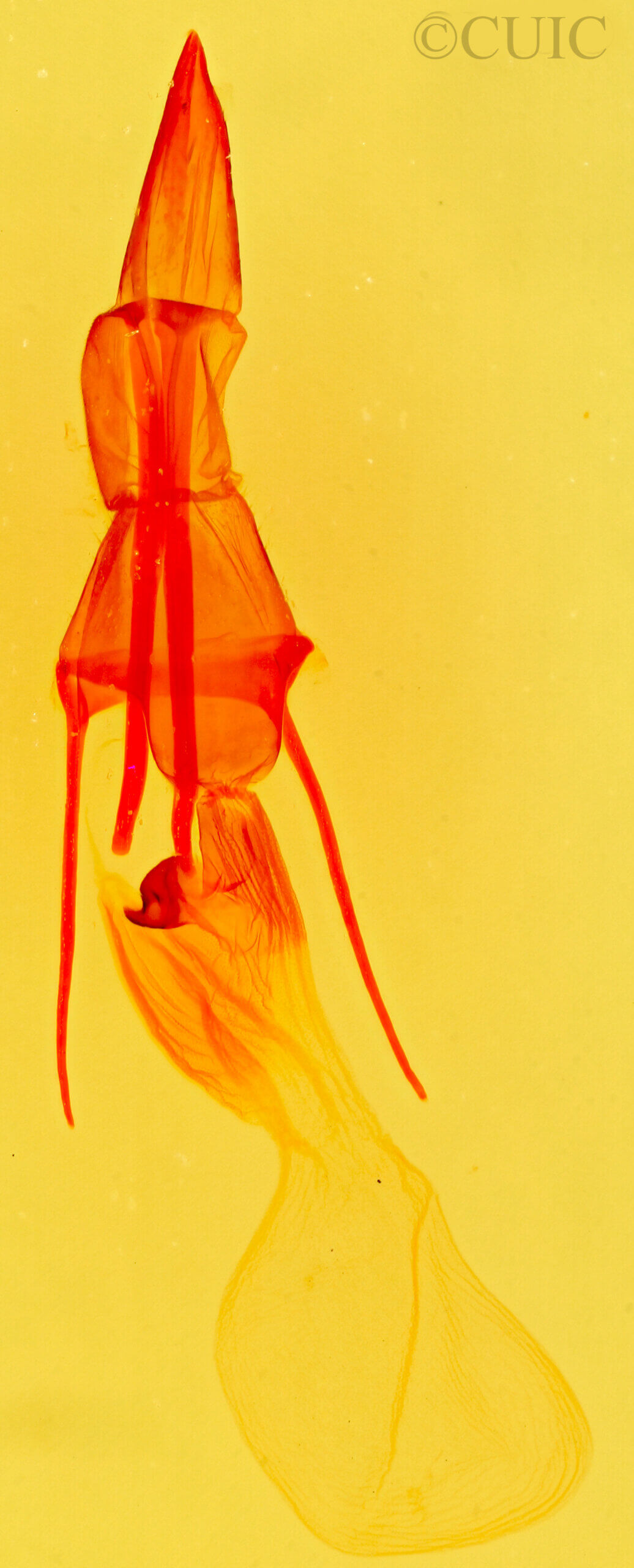 genitalia view of adult Plagiomimicus