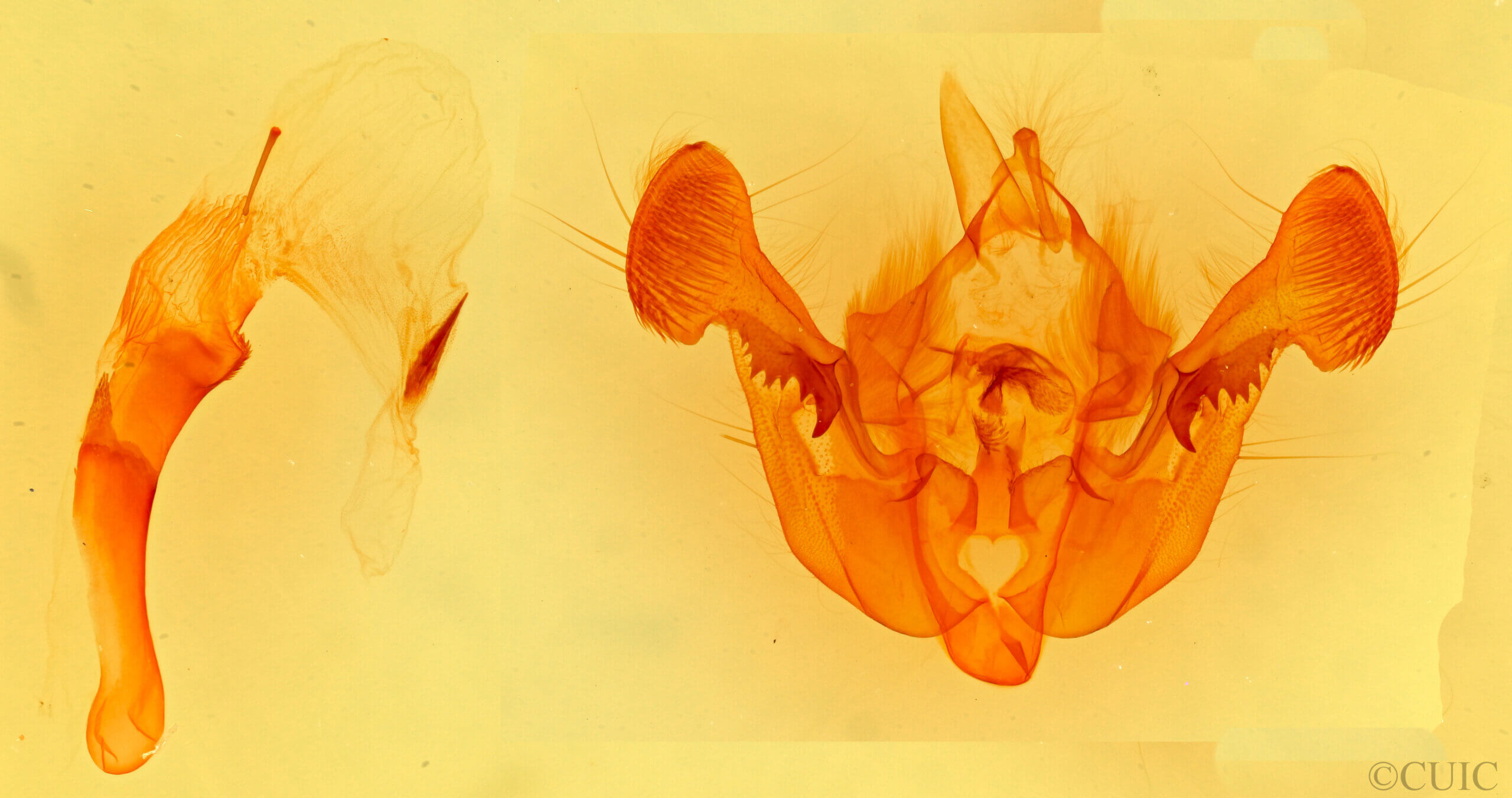 genitalia view of adult Mesapamea arbora