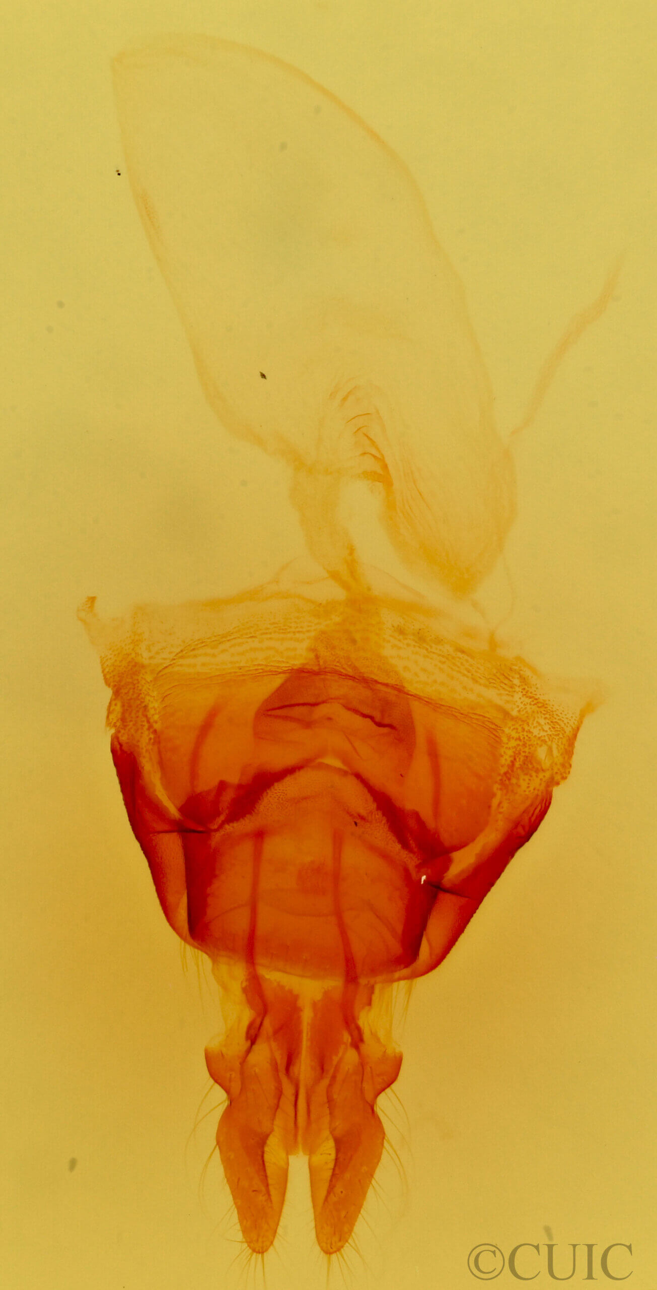 genitalia view of adult Mesapamea arbora