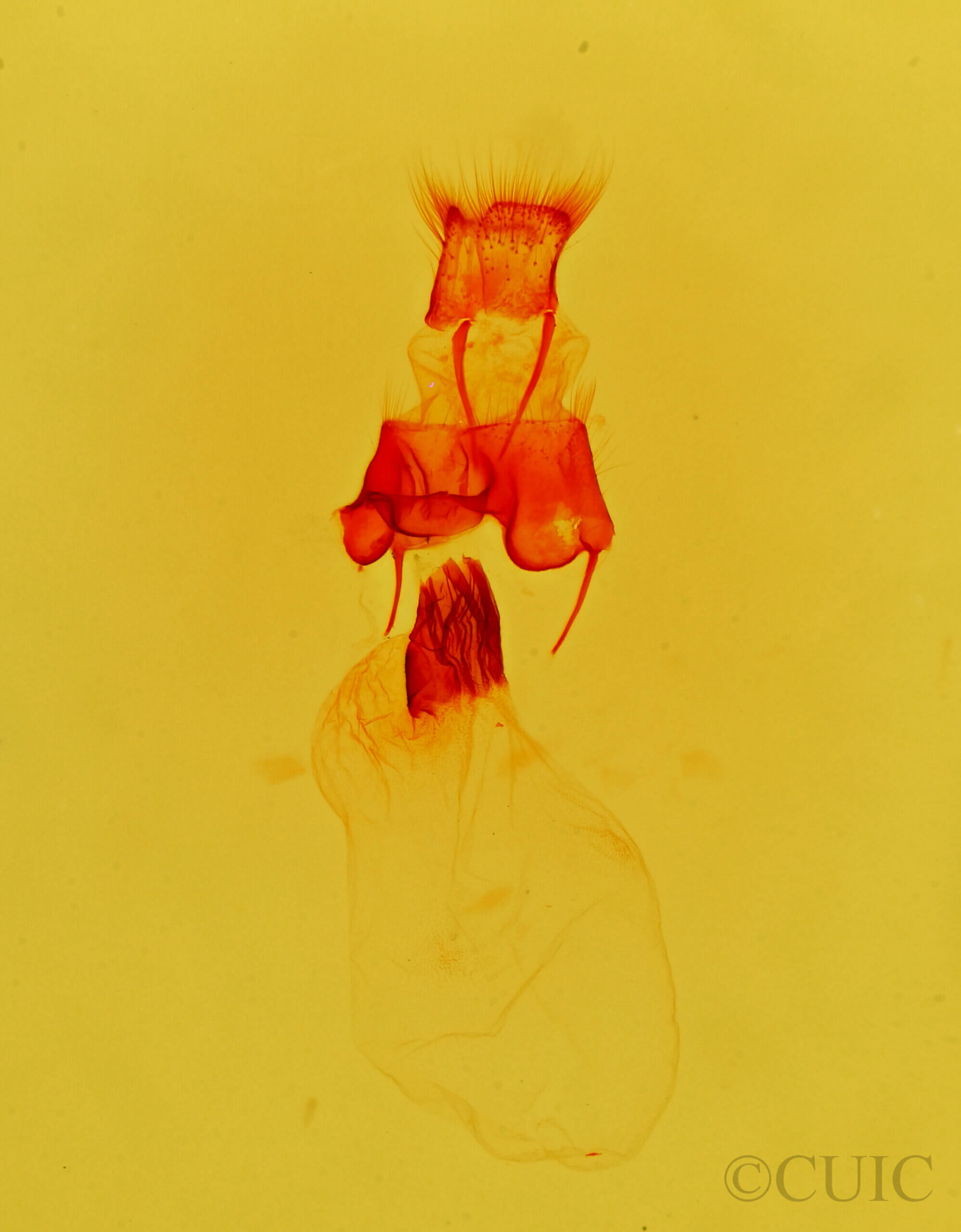 genitalia view of adult Plagiomimicus