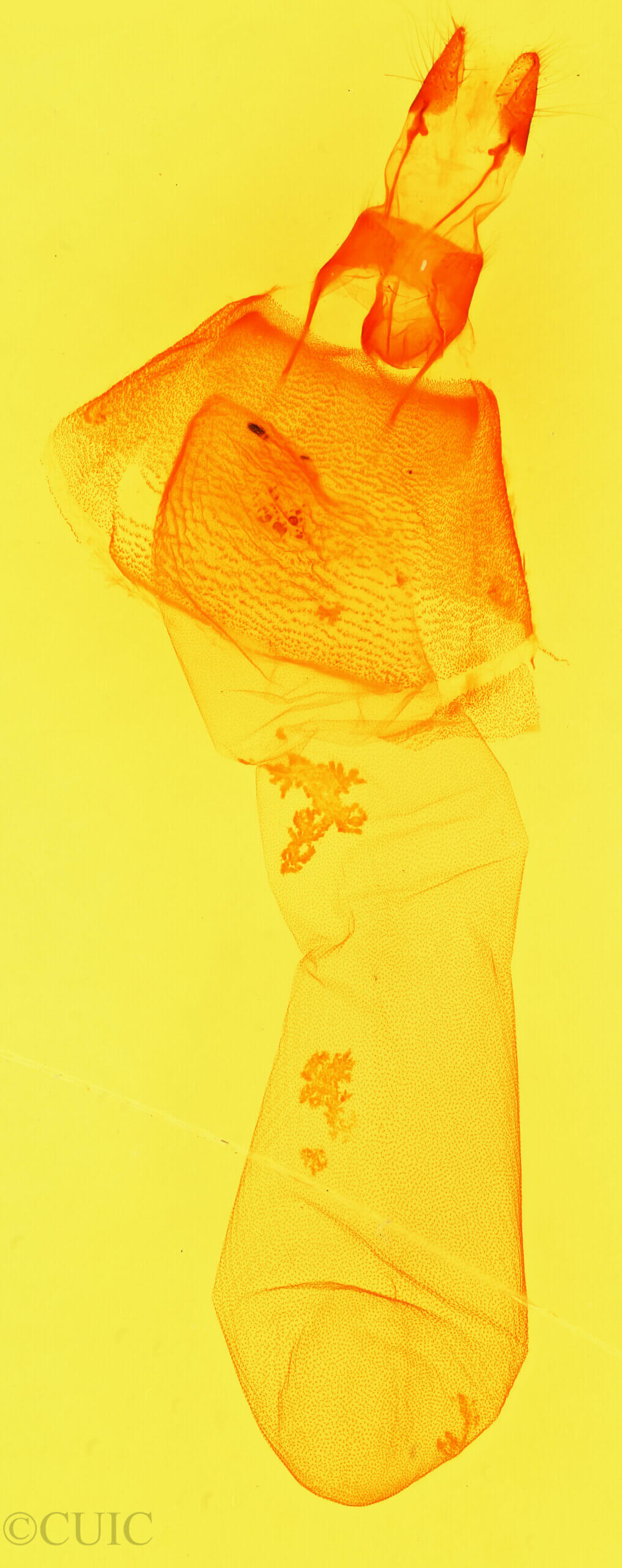 genitalia view of adult Heminocloa mirabilis