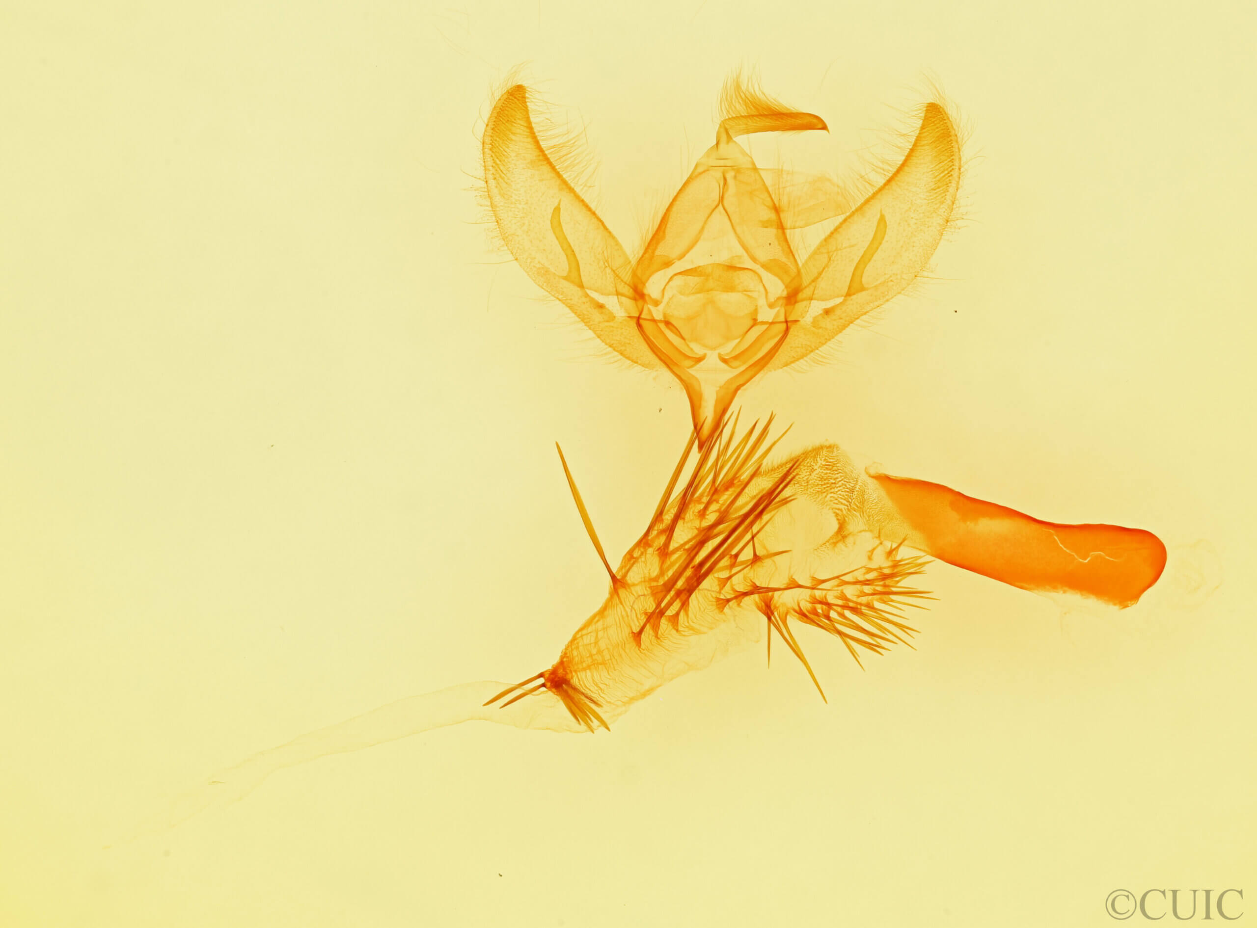 genitalia view of adult Paramiana perissa