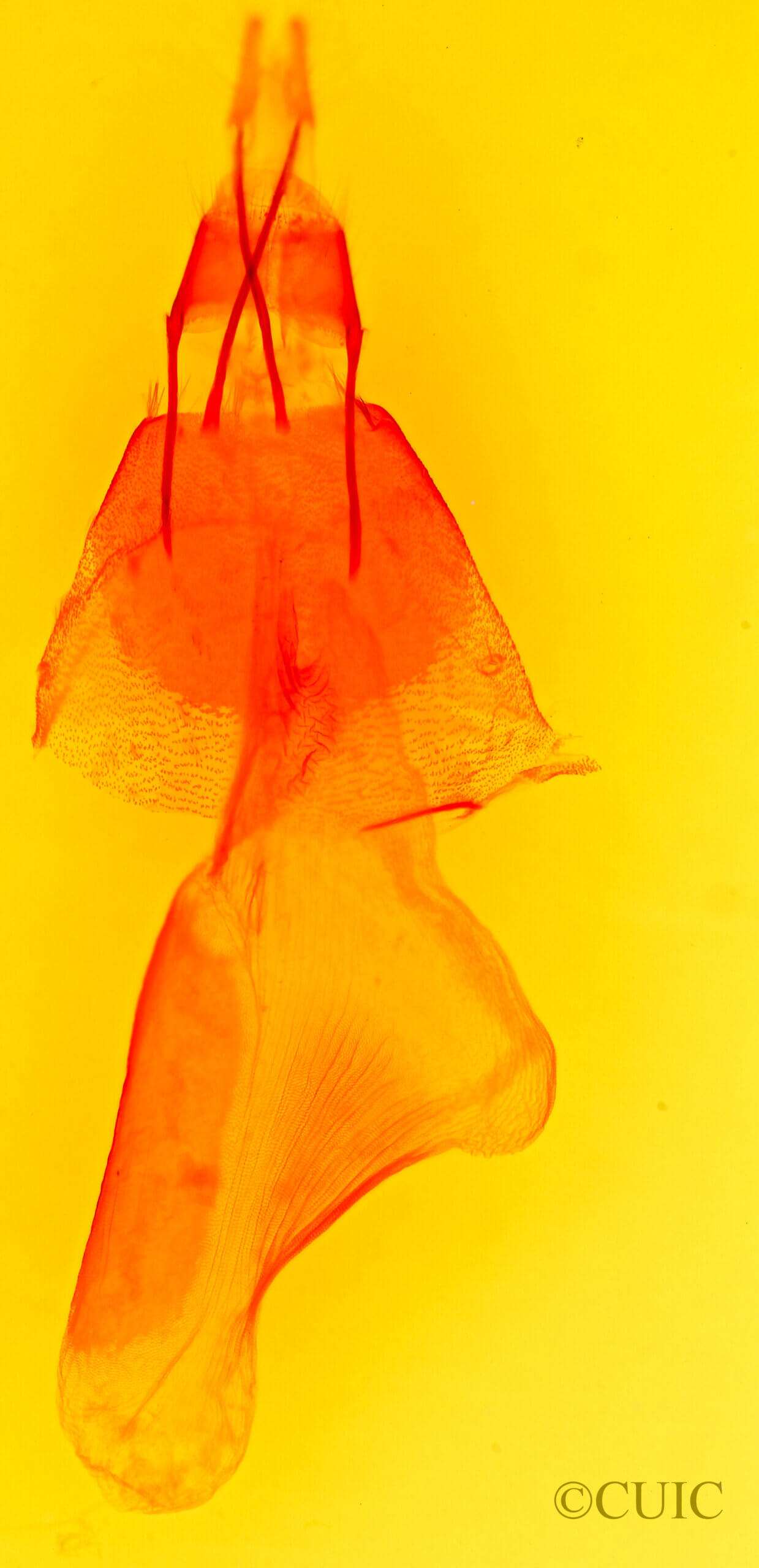 genitalia view of adult Paramiana perissa