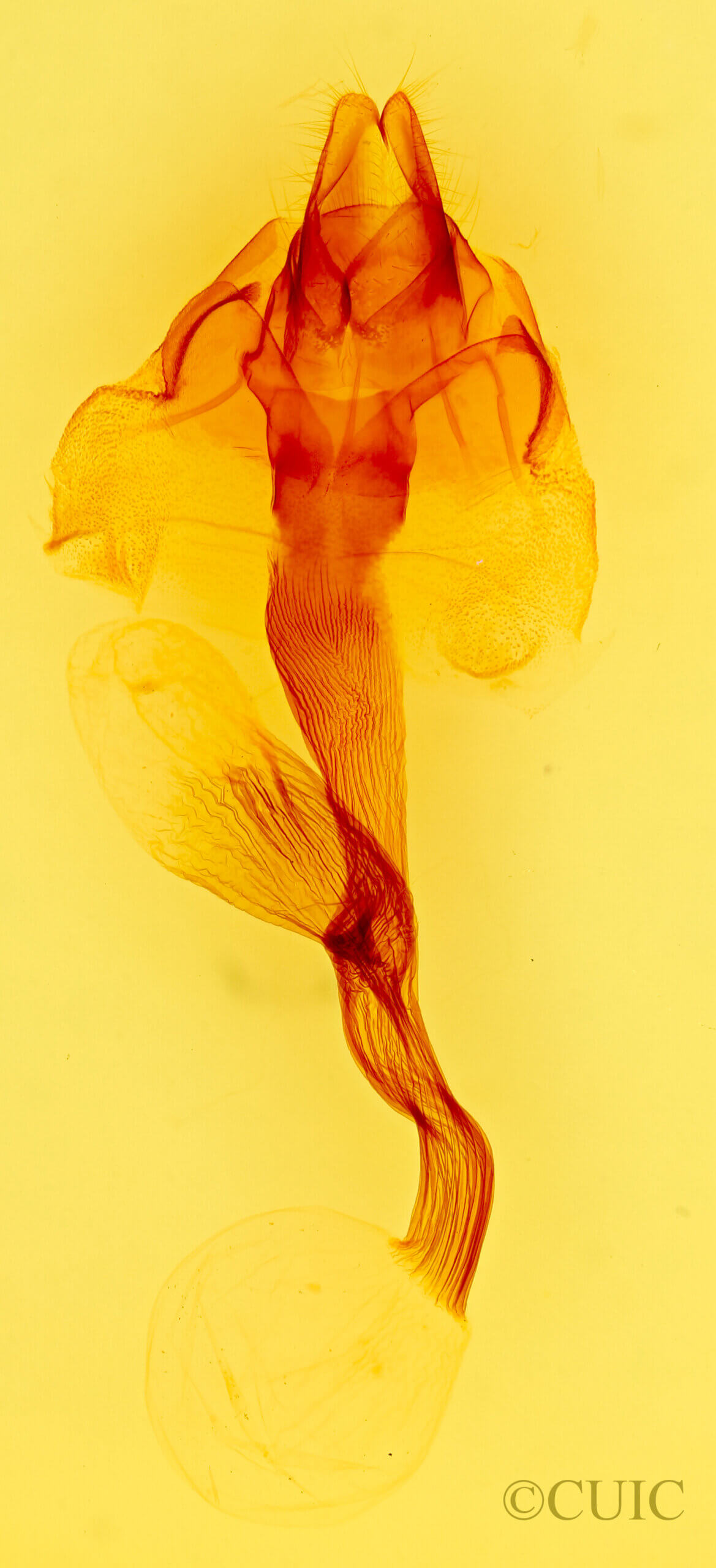 genitalia view of adult Leucania stolata