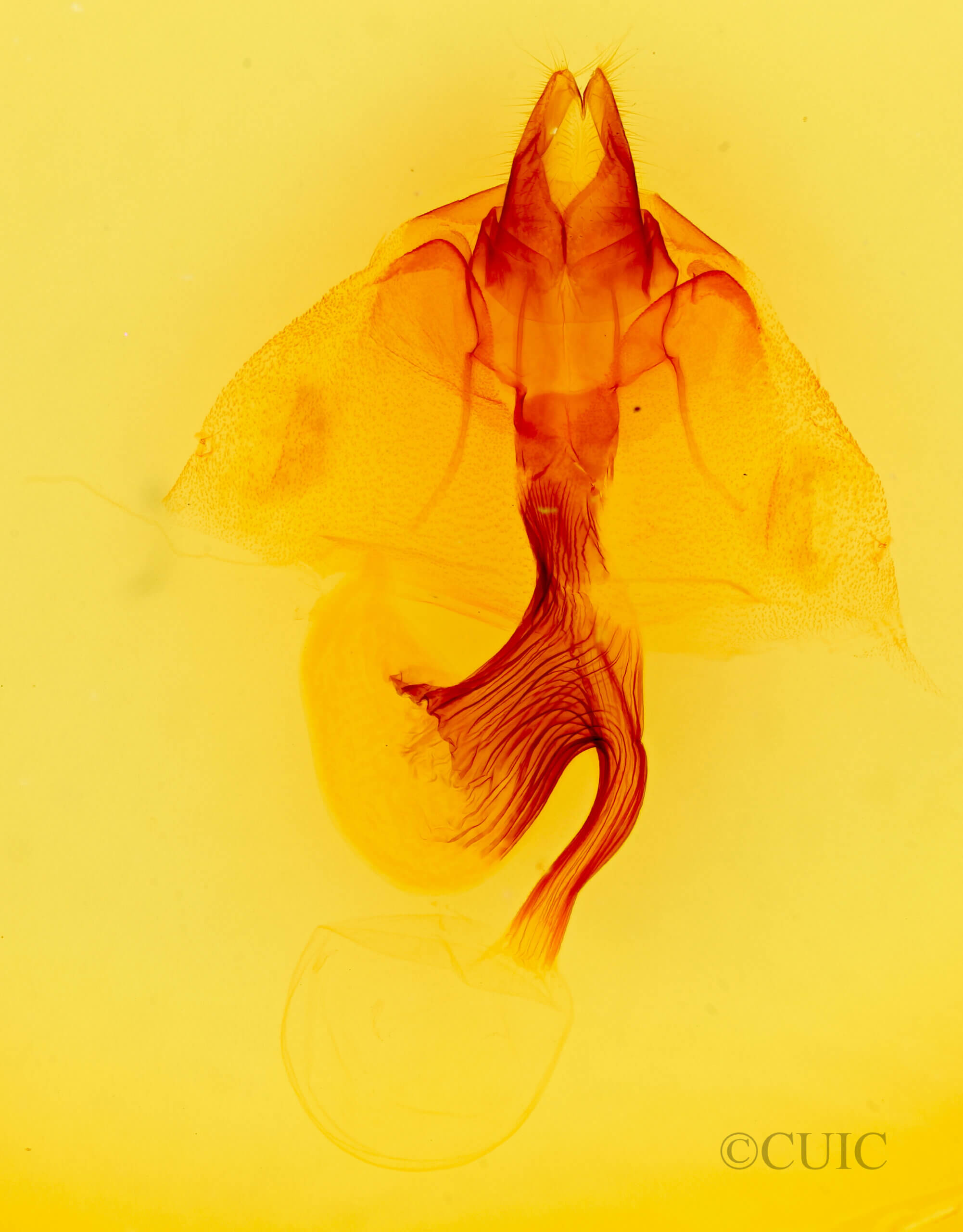 genitalia view of adult Leucania