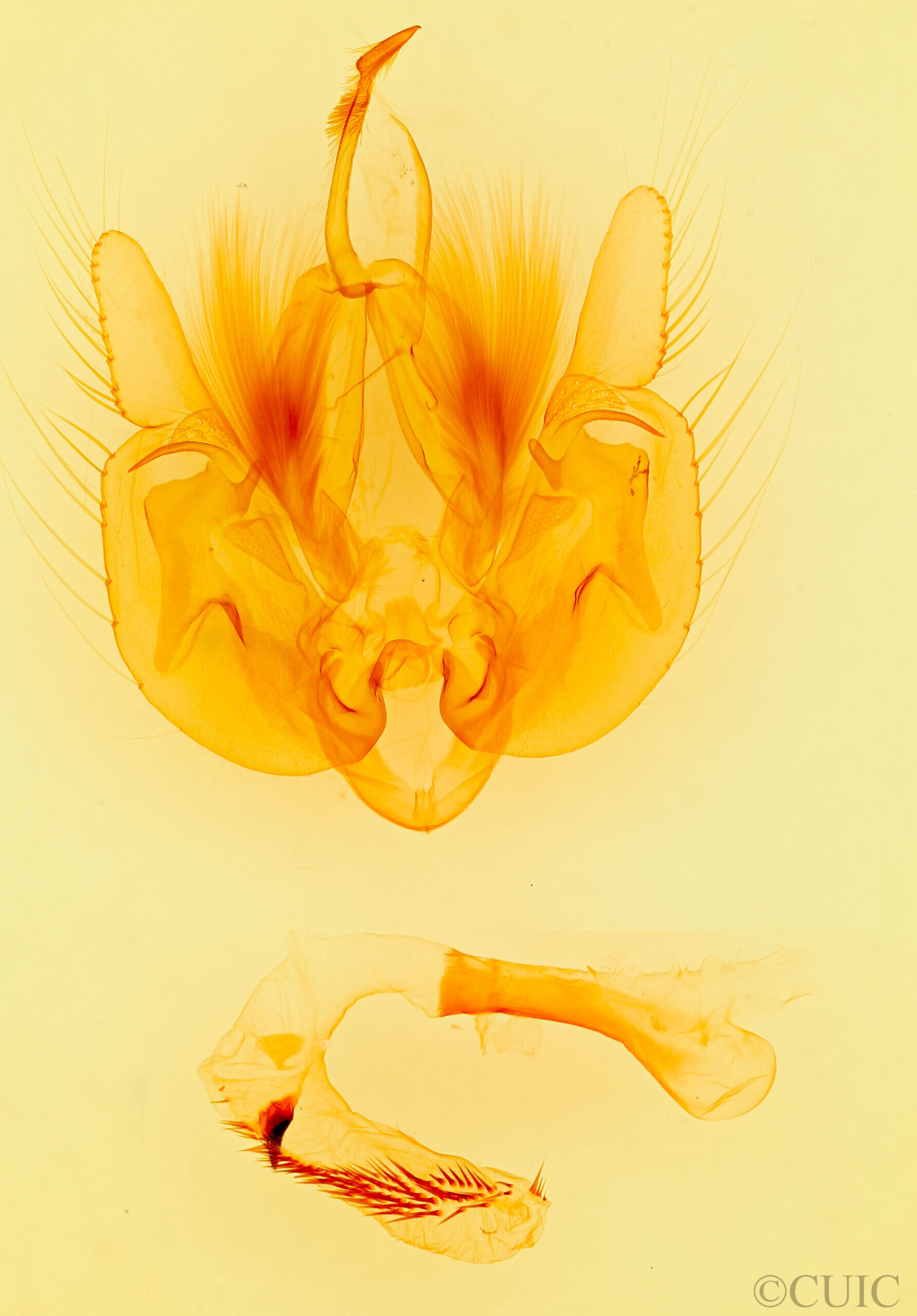 genitalia view of adult Leucania