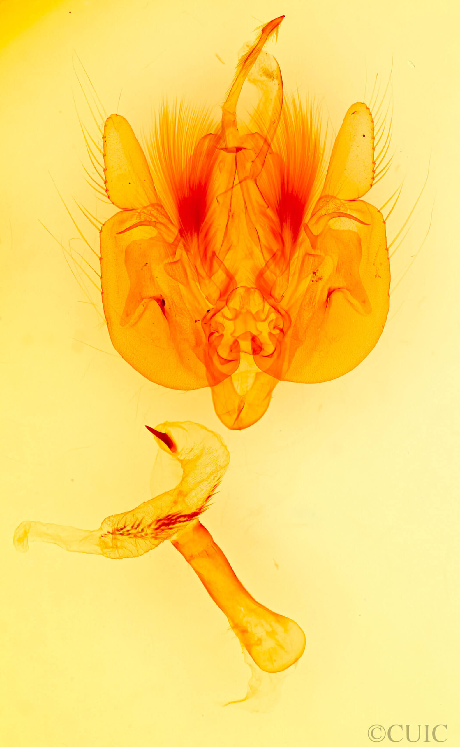 genitalia view of adult Leucania