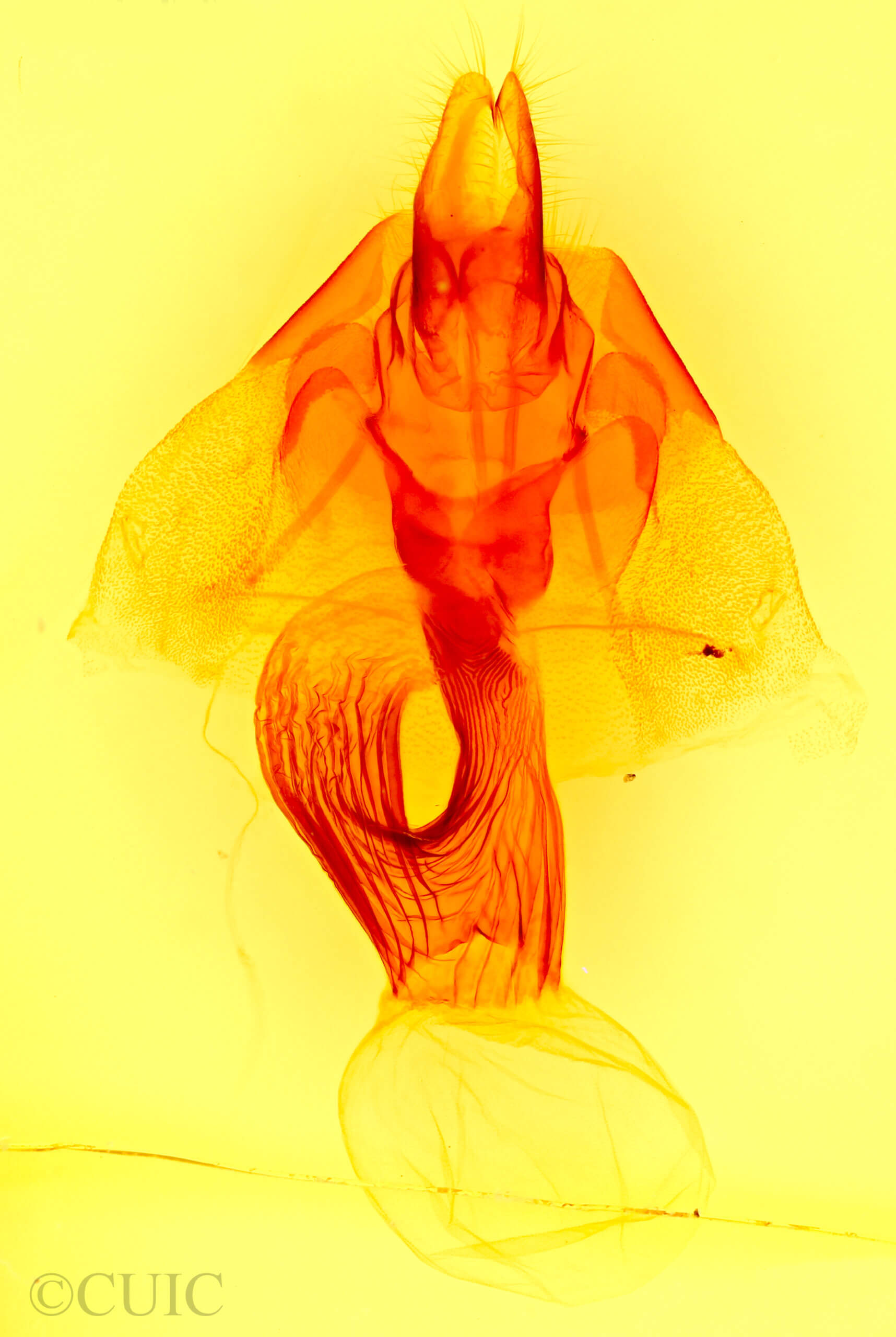 genitalia view of adult Leucania