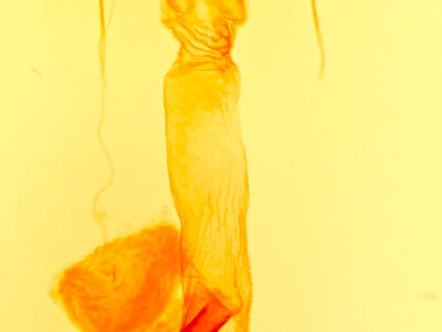 genitalia view of adult Lacinipolia