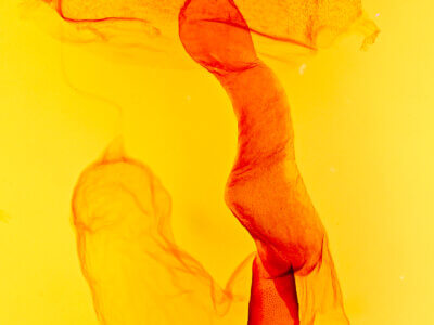 genitalia view of adult Lacinipolia