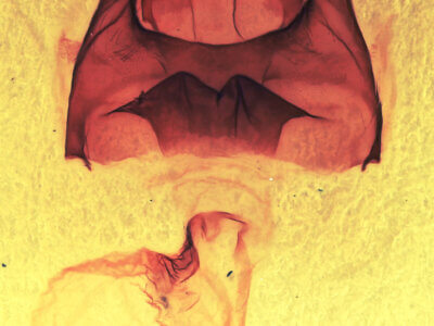 genitalia view of adult Datana ministra