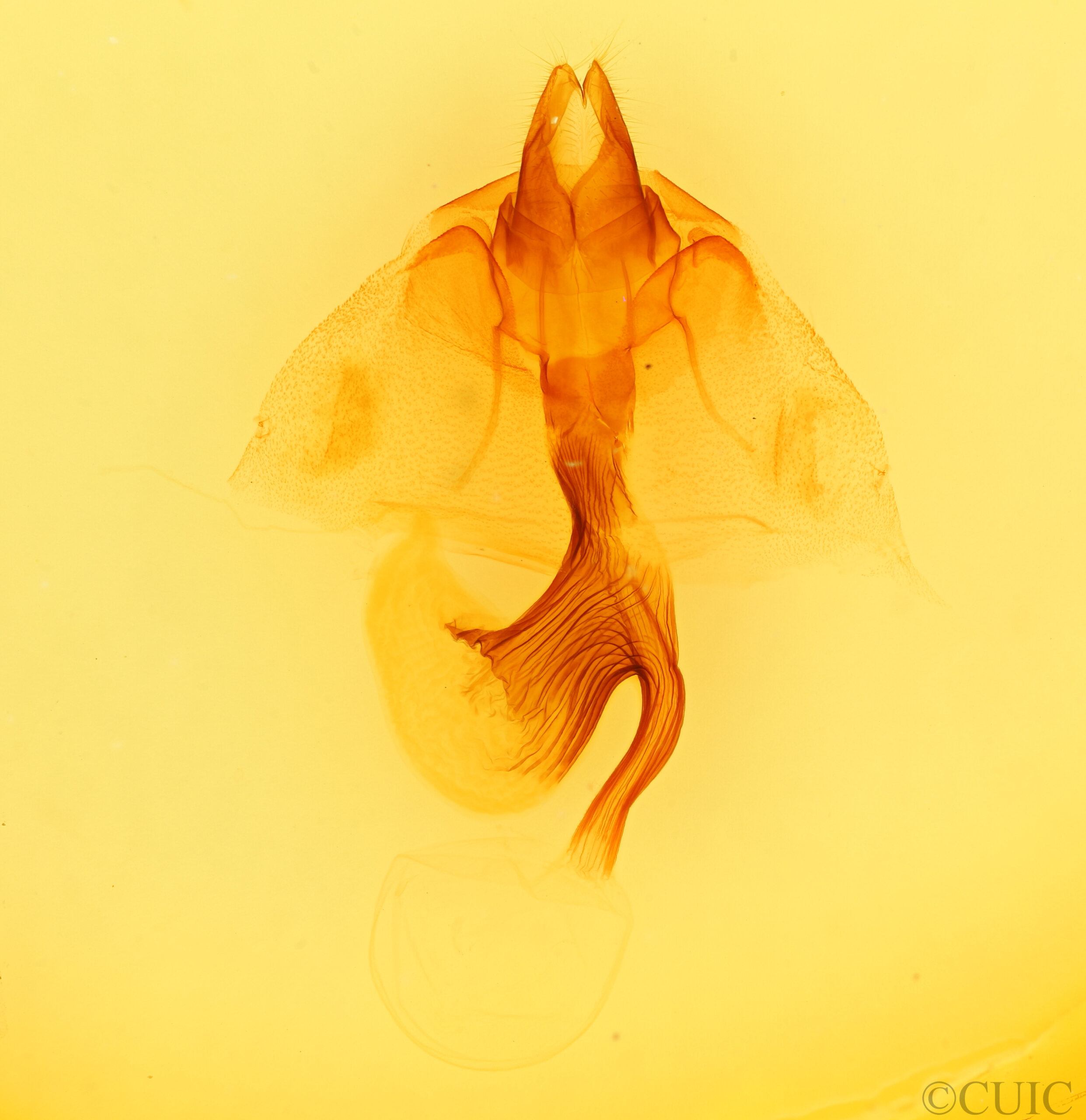 genitalia view of adult Leucania stolata