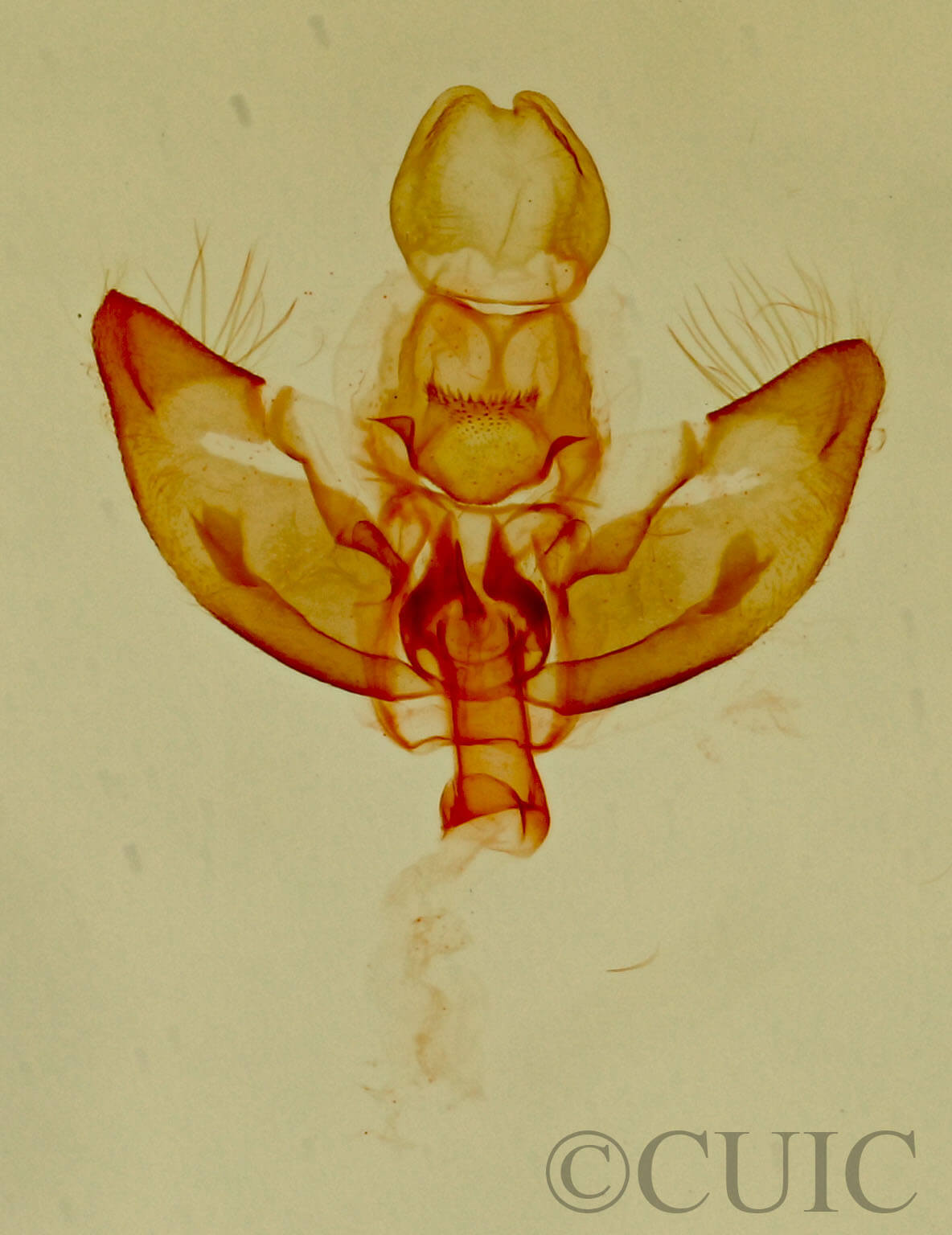 genitalia view of adult Ethmia sp.