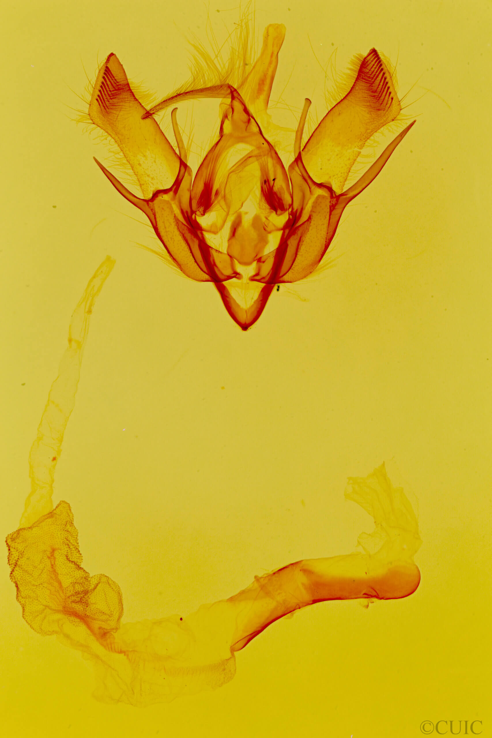 genitalia view of adult Euxoa gasta