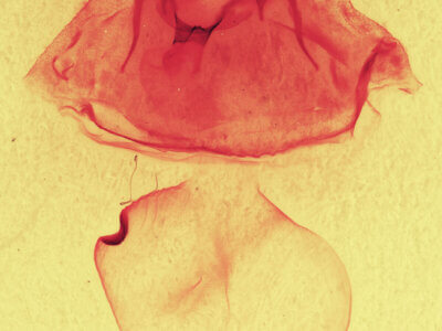 genitalia view of adult Gluphisia septentrionis