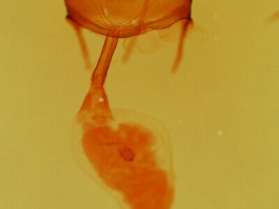 genitalia view of adult Synglochis perumbraria