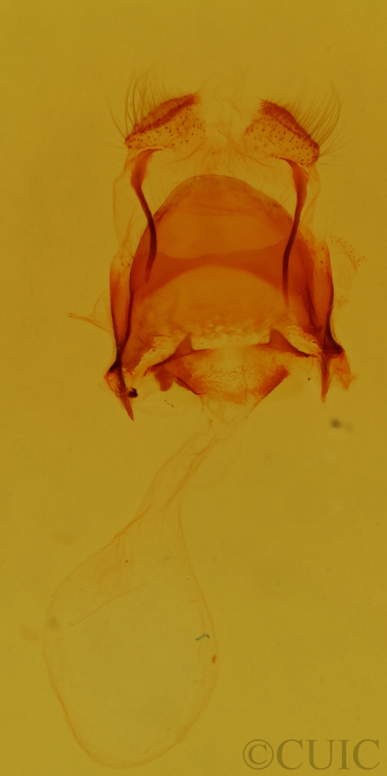 genitalia view of adult Astiptodonta aonides