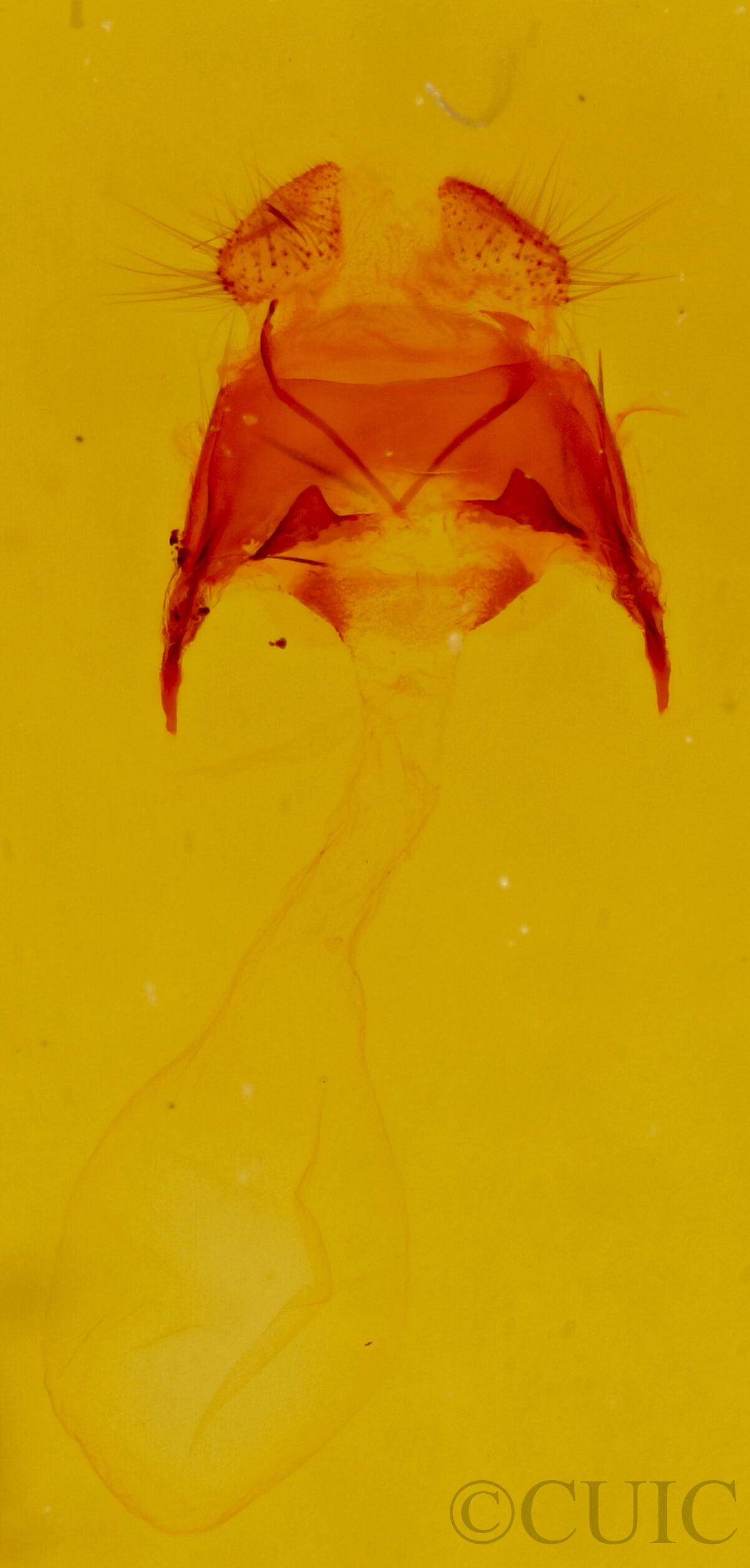 genitalia view of adult Astiptodonta aonides