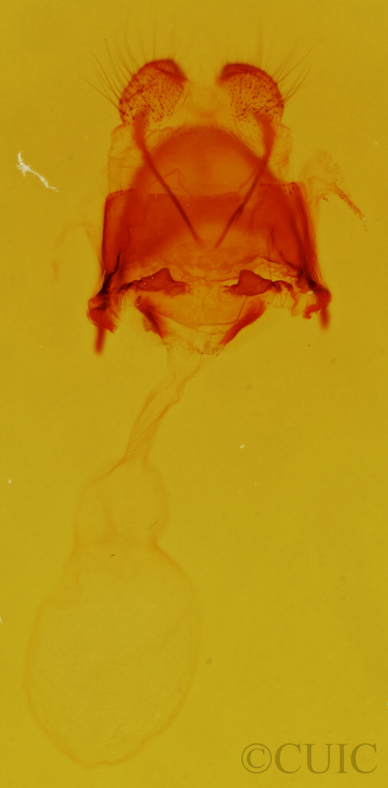 genitalia view of adult Astiptodonta wymola