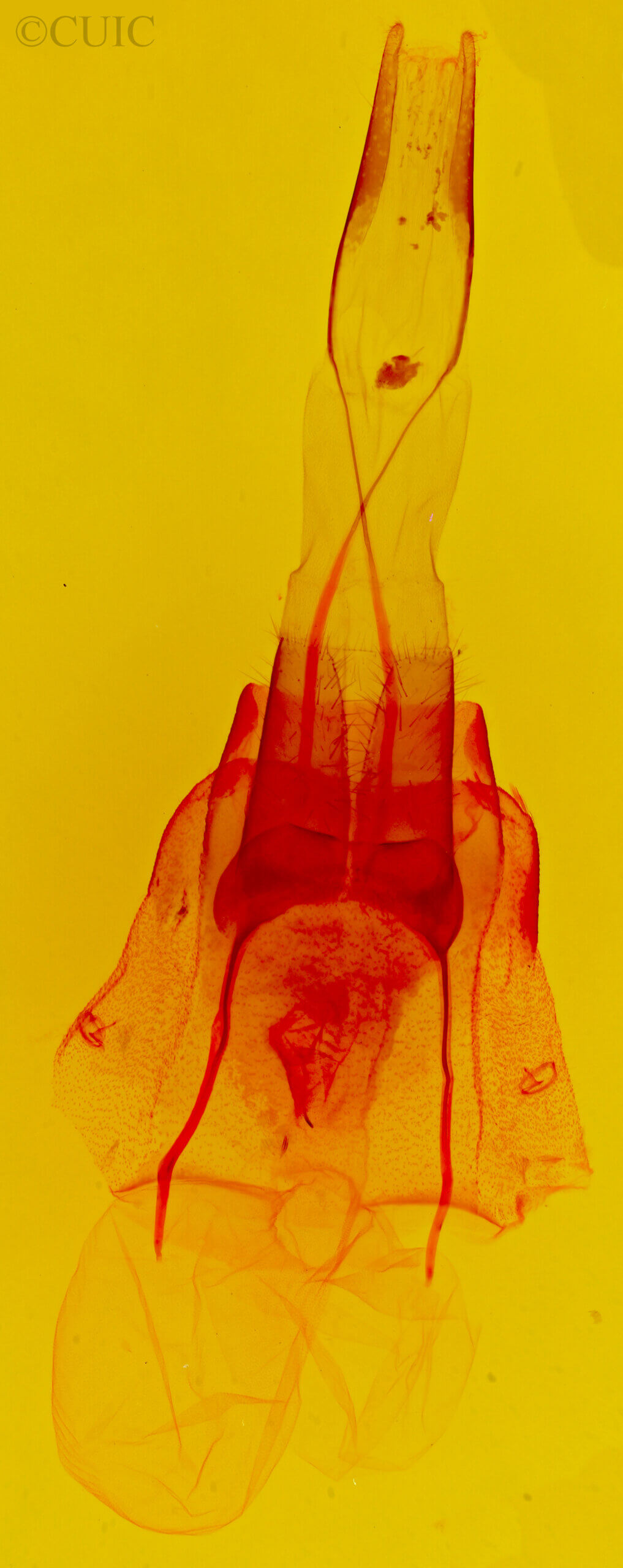 genitalia view of adult Protorthodes utahensis ?