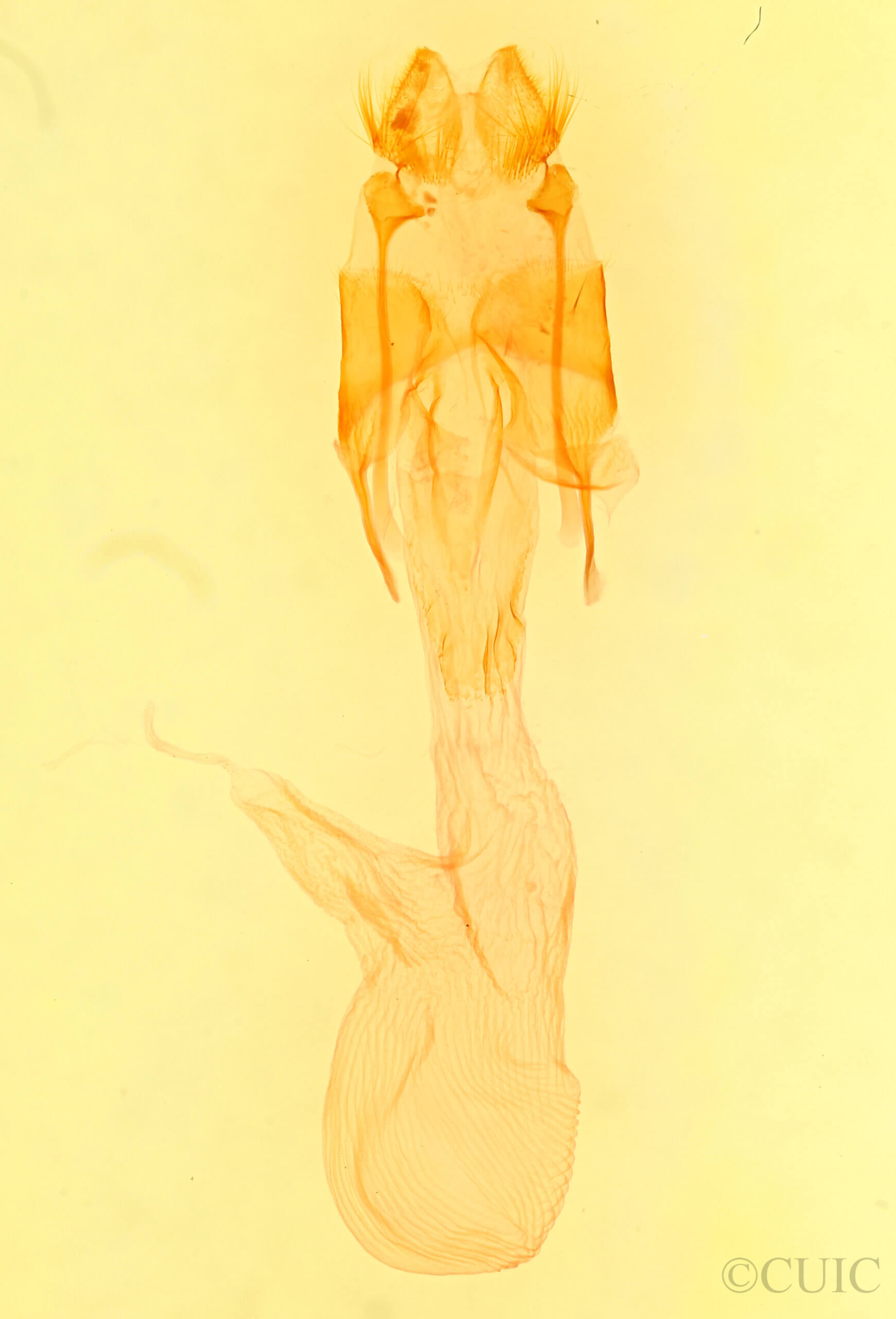 genitalia view of adult Euxoa antica