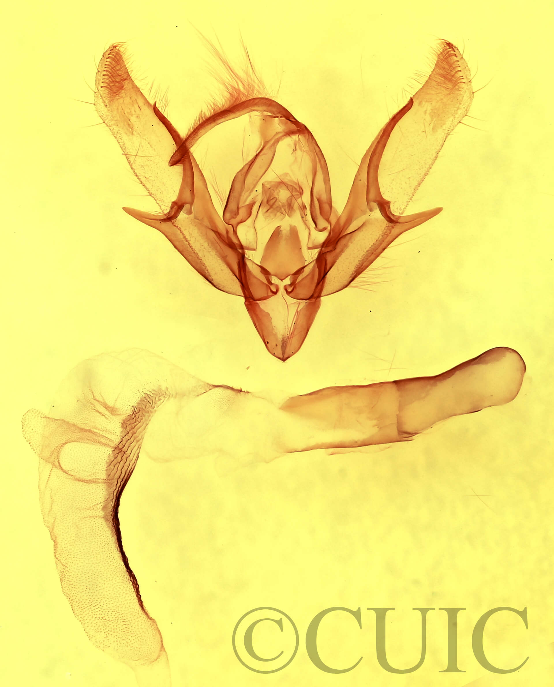 genitalia view of adult Euxoa maderensis