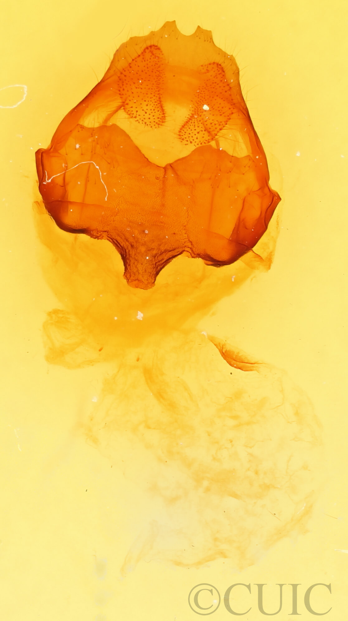 genitalia view of adult Pheosia rimosa