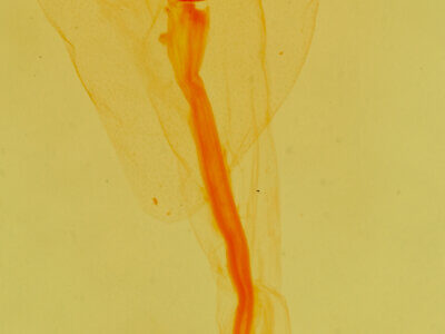 genitalia view of adult Dichagyris longidens