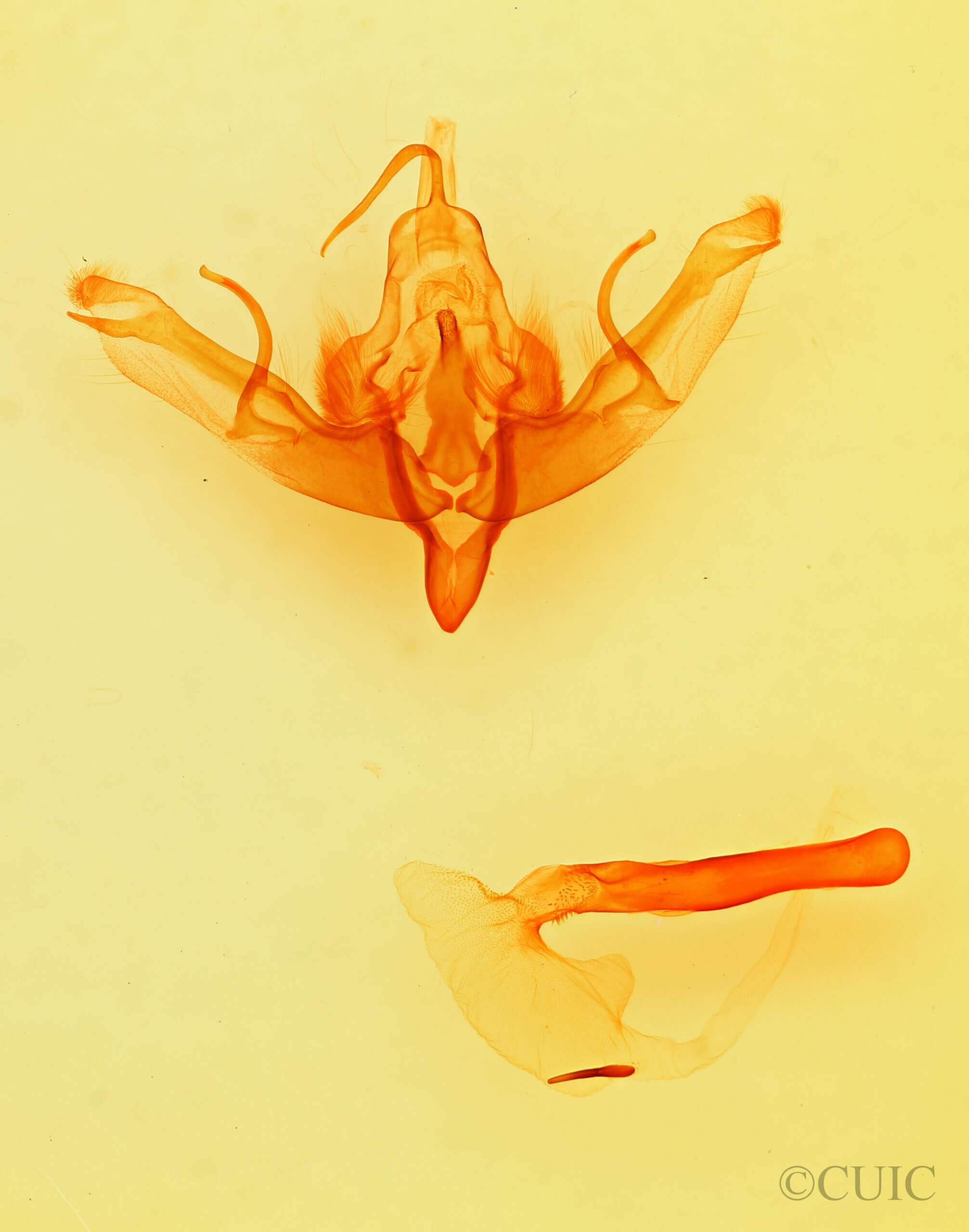 genitalia view of adult Pseudohadena vulnerea