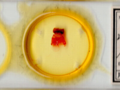 slide view of adult Pseudohadena vulnerea