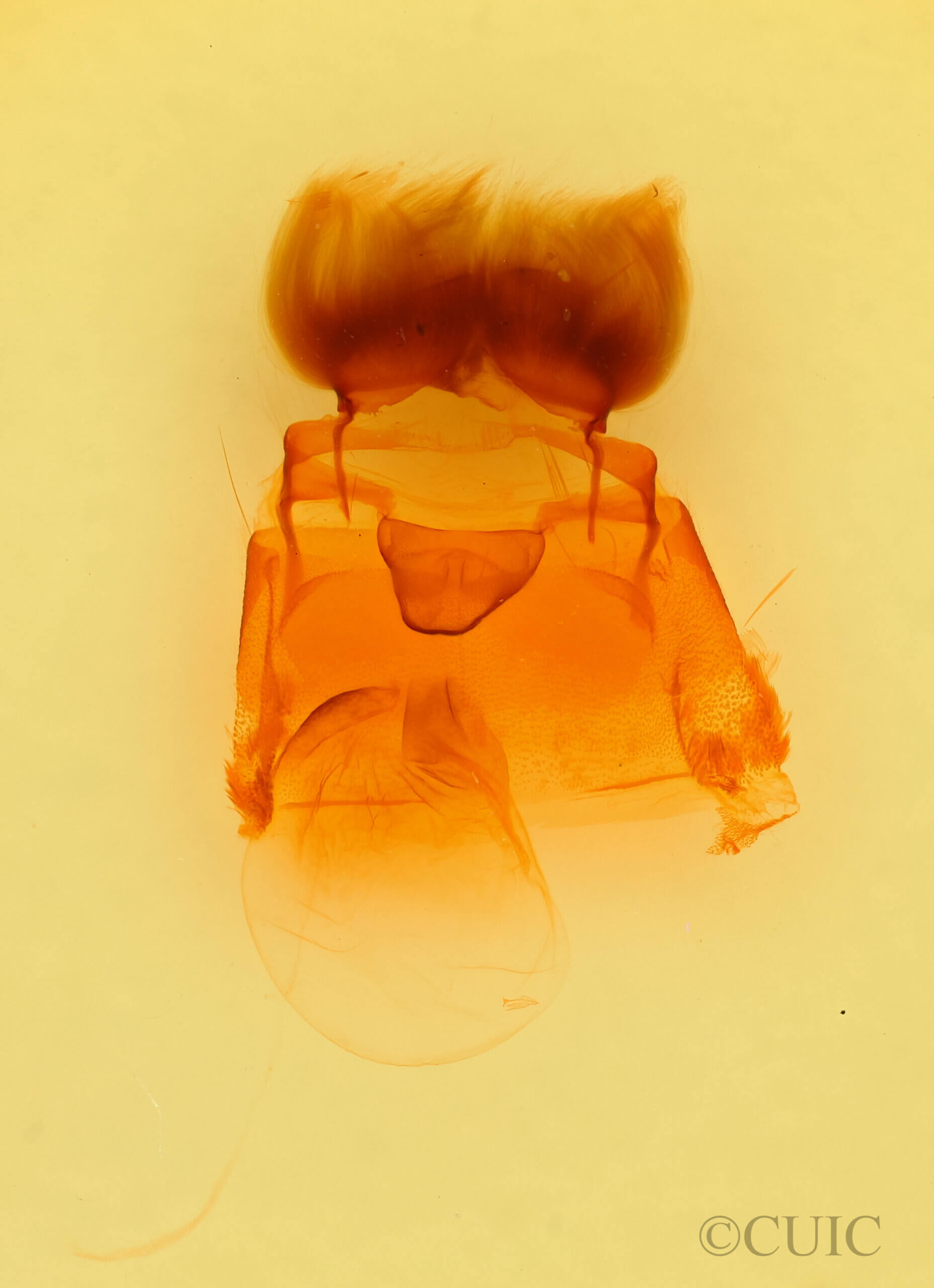 genitalia view of adult Pseudohadena vulnerea