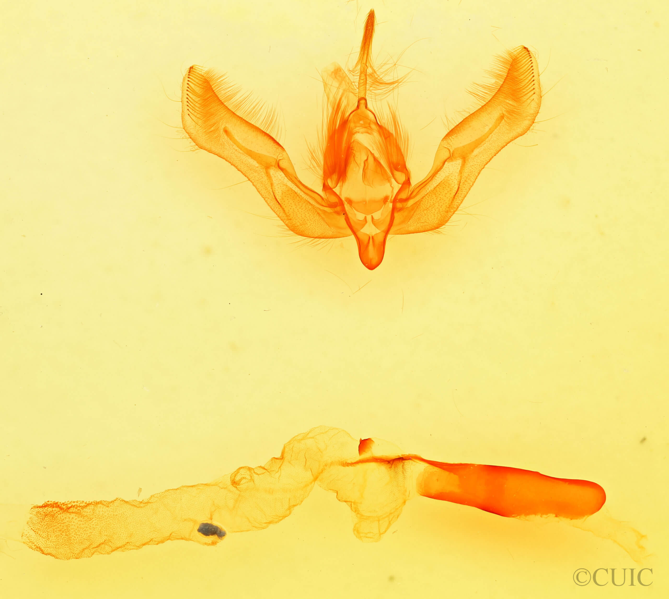 genitalia view of adult Feltia tricosa