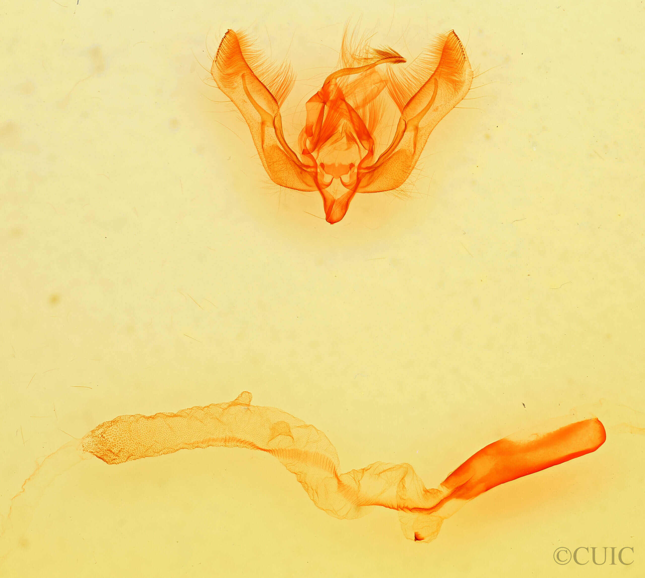 genitalia view of adult Feltia subgothica