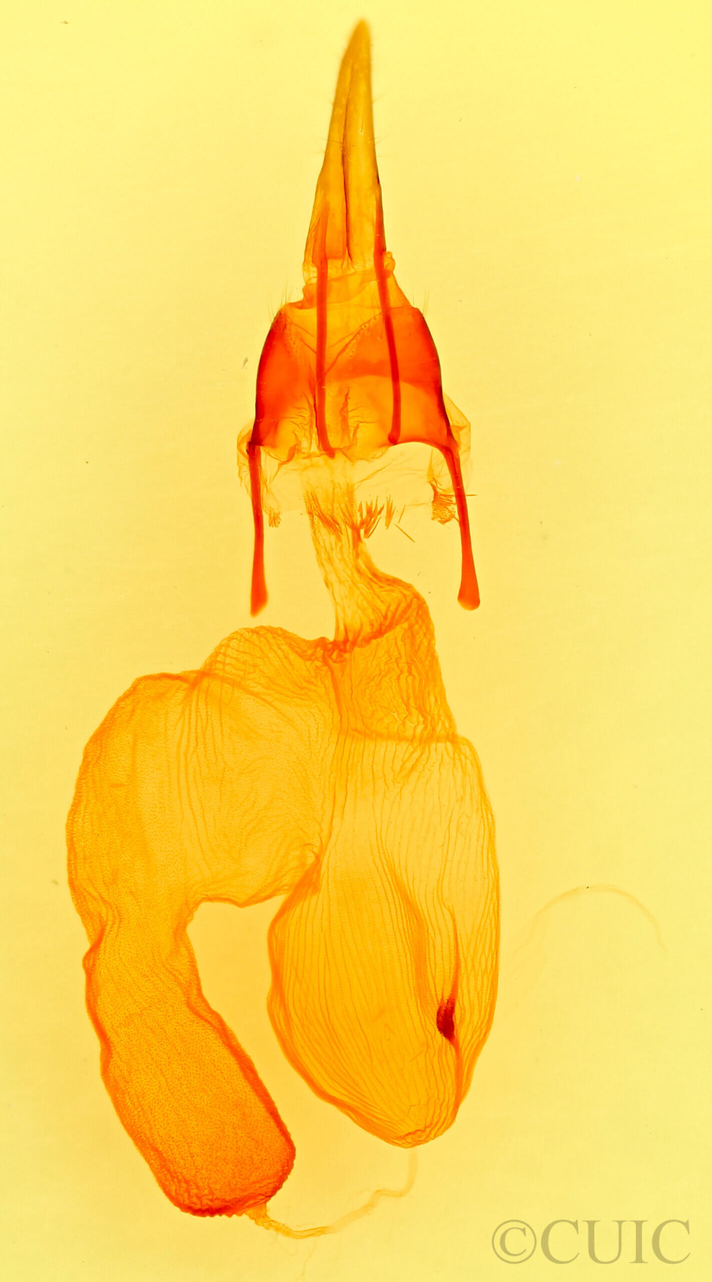 genitalia view of adult Feltia subgothica