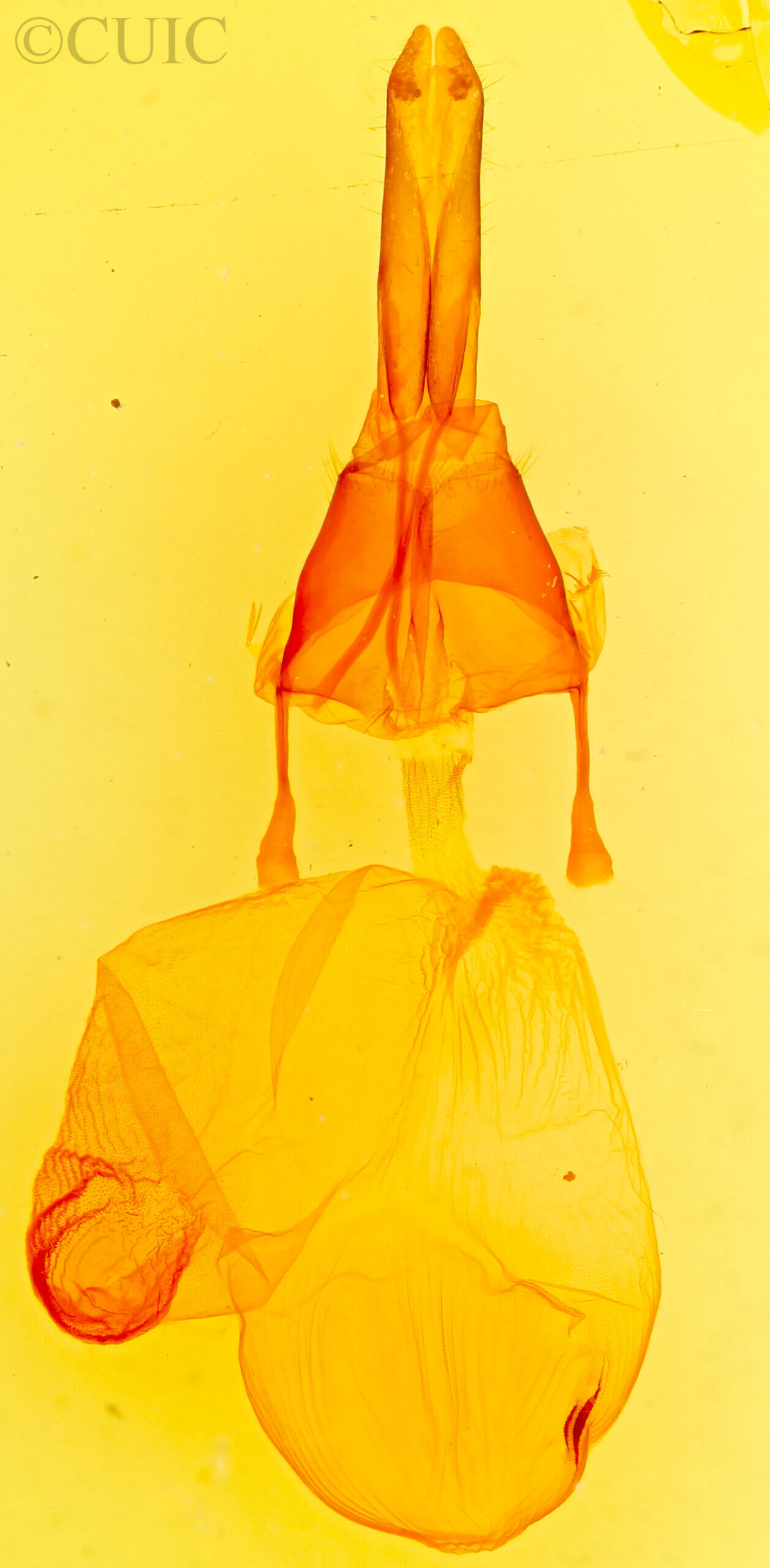 genitalia view of adult Feltia tricosa