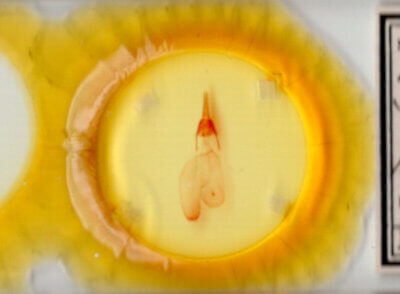 slide view of adult Feltia subgothica